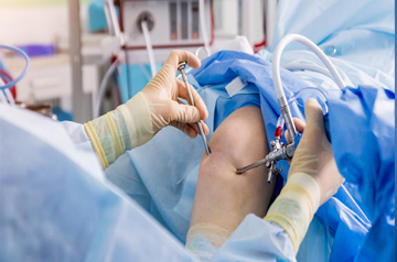 acl-doctor-surgery-in-jaipur