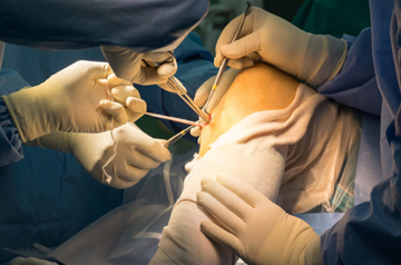 acl-doctor-surgery-in-jaipur