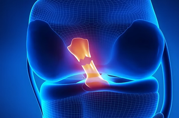 acl-treatment-in-rajasthan