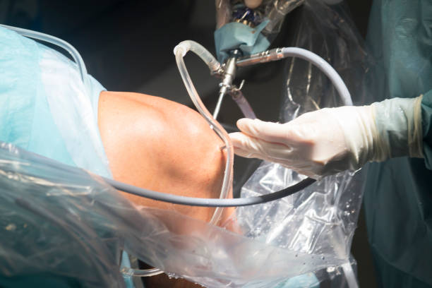 arthroscopy surgery