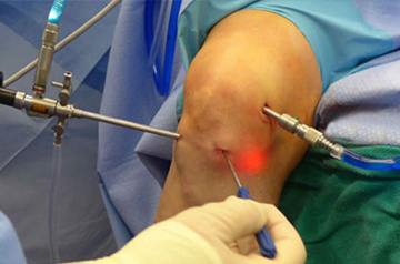 leg and foot injury treatment in ajmer