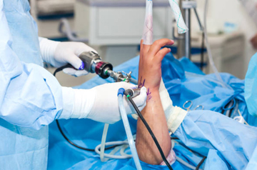 arthroscopy-surgery-in-sikar