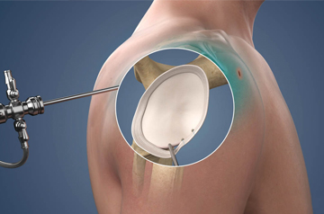 leg and foot injury treatment in ajmer