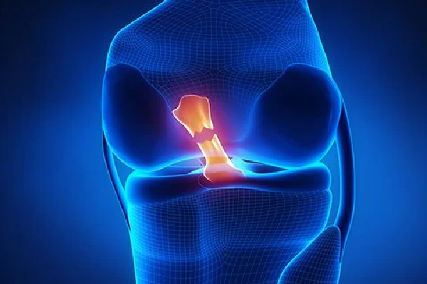 Best Knee Ligament Repair In Delhi