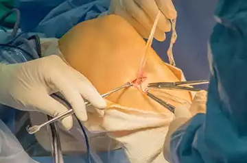 leg and foot injury treatment in ajmer