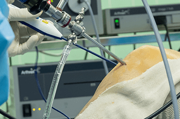 leg and foot injury treatment in ajmer