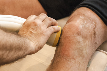 knee-injury-treatment-in-rajasthan