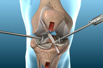 leg and foot injury treatment in ajmer