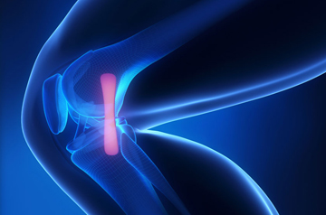 ligament-injury-treatment-in-rajasthan