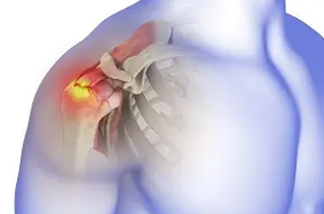 rotator-cuff-tear-surgery-in-rajasthan