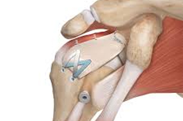 leg and foot injury treatment in ajmer