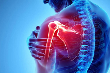 shoulder-pain-treatment-in-rajasthan
