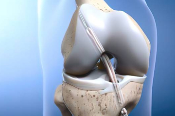 acl-doctor-in-sikar