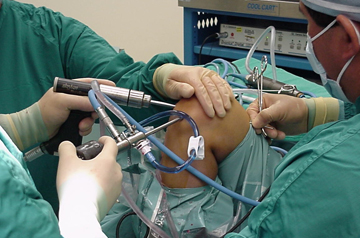 acl-surgeon-ajmer