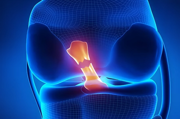 acl-tear-surgery-in-sikar