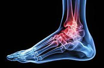 ankle-ligament-surgery-in-sikar
