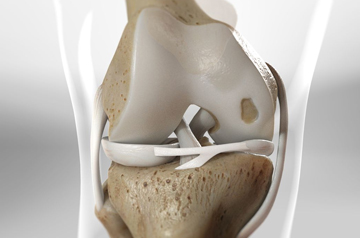 cartilage-injury-treatment-in-ajmer