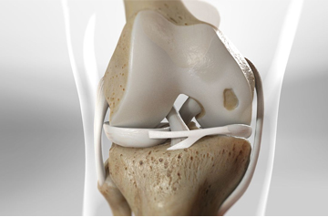 cartilage-injurytreatment-in-sikar