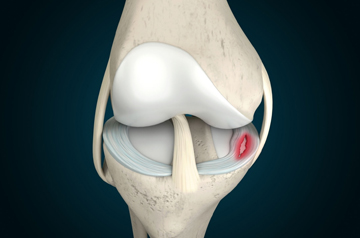 leg and foot injury treatment in ajmer