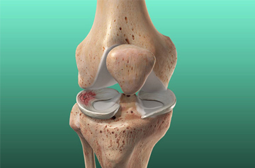 leg and foot injury treatment in ajmer