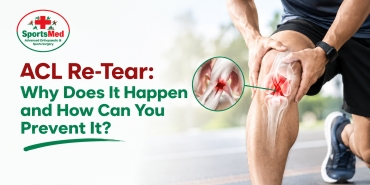 ACL Re-Tear: Causes, Prevention and Recovery