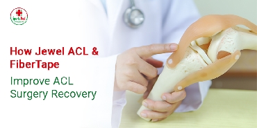 ACL Surgery