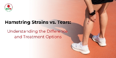Hamstring Strains vs. Tears: Understanding the Difference and Treatment Options 