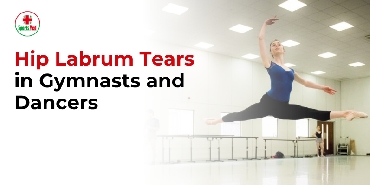 Hip Labrum Tears in Gymnasts and Dancers 