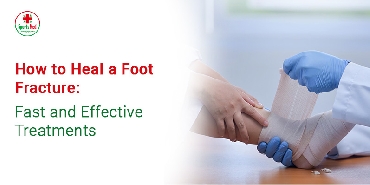 How to Heal a Foot Fracture: Fast and Effective Treatments