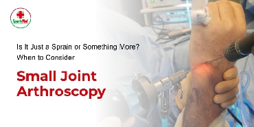 Is It Just a Sprain or Something More? When to Consider Small Joint Arthroscopy