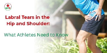 Labral Tears in the Hip and  Shoulder: What Athletes Need to Know 