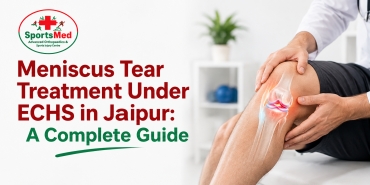Meniscus Tear Treatment Under ECHS in Jaipur