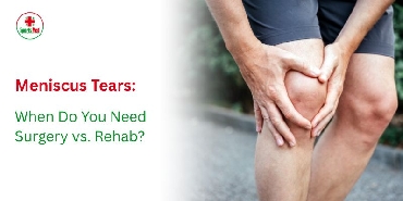 Meniscus Tears: When Do You Need Surgery vs. Rehab? 