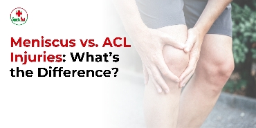 Meniscus vs. ACL Injuries: What’s the Difference? 