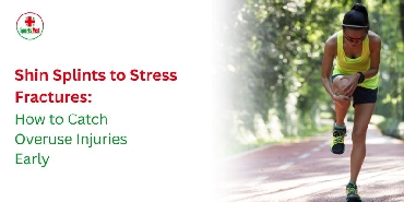 Shin Splints to Stress Fractures: How to Catch Overuse Injuries Early 