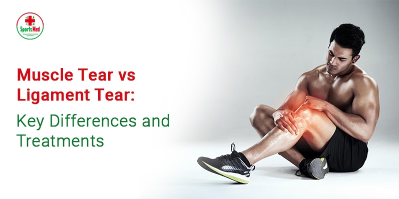 Muscle Tear vs Ligament Tear: Key Differences and Treatments