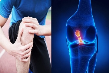Knee Ligament Repair Bangladesh