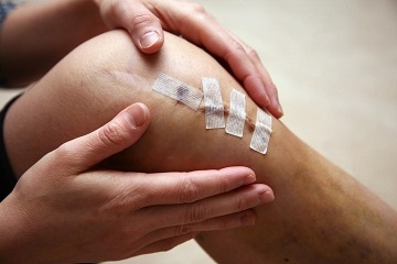 Knee Ligament Repair In Bangladesh