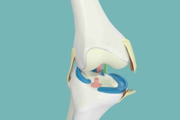 Knee Ligament Repairing in Arab