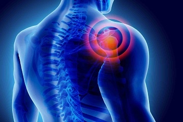 Shoulder Sports Injury Treatment Dubai